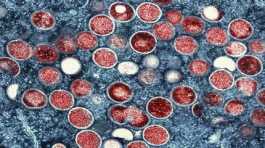 mpox particles